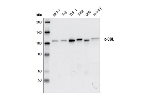 Western Blotting Image 1: c-Cbl Antibody