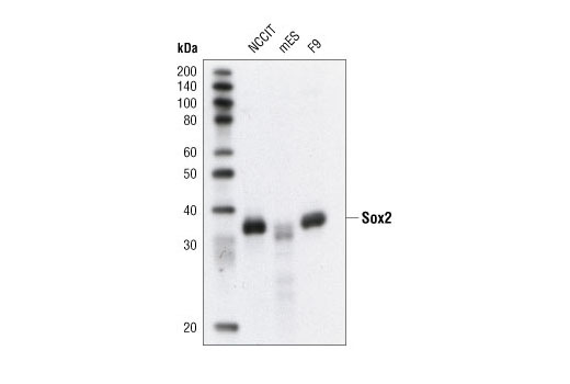 Western Blotting Image 1: Sox2 Antibody