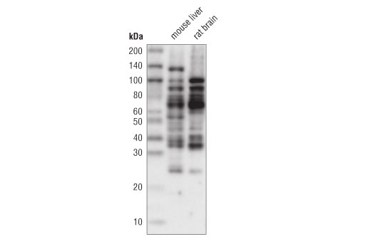 Western Blotting Image 1: Mono-Methyl Arginine (R*GG) (D5A12) Rabbit mAb (HRP Conjugate)