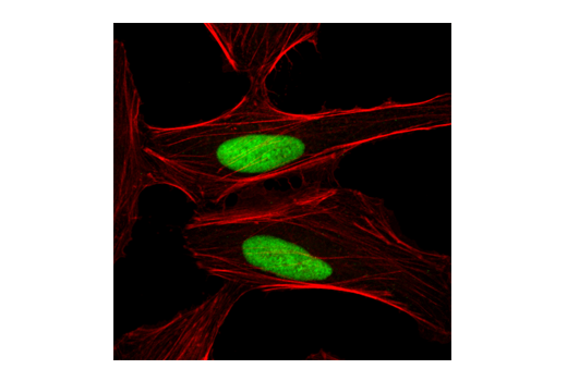 Immunofluorescence Image 1: Ku80 Antibody