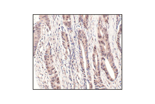  Image 15: CRL4/CRBN Targeted Protein Degradation Complex Antibody Sampler Kit
