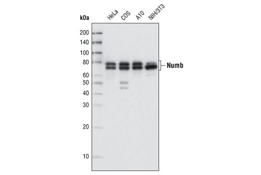  Image 6: Notch Receptor Interaction Antibody Sampler Kit