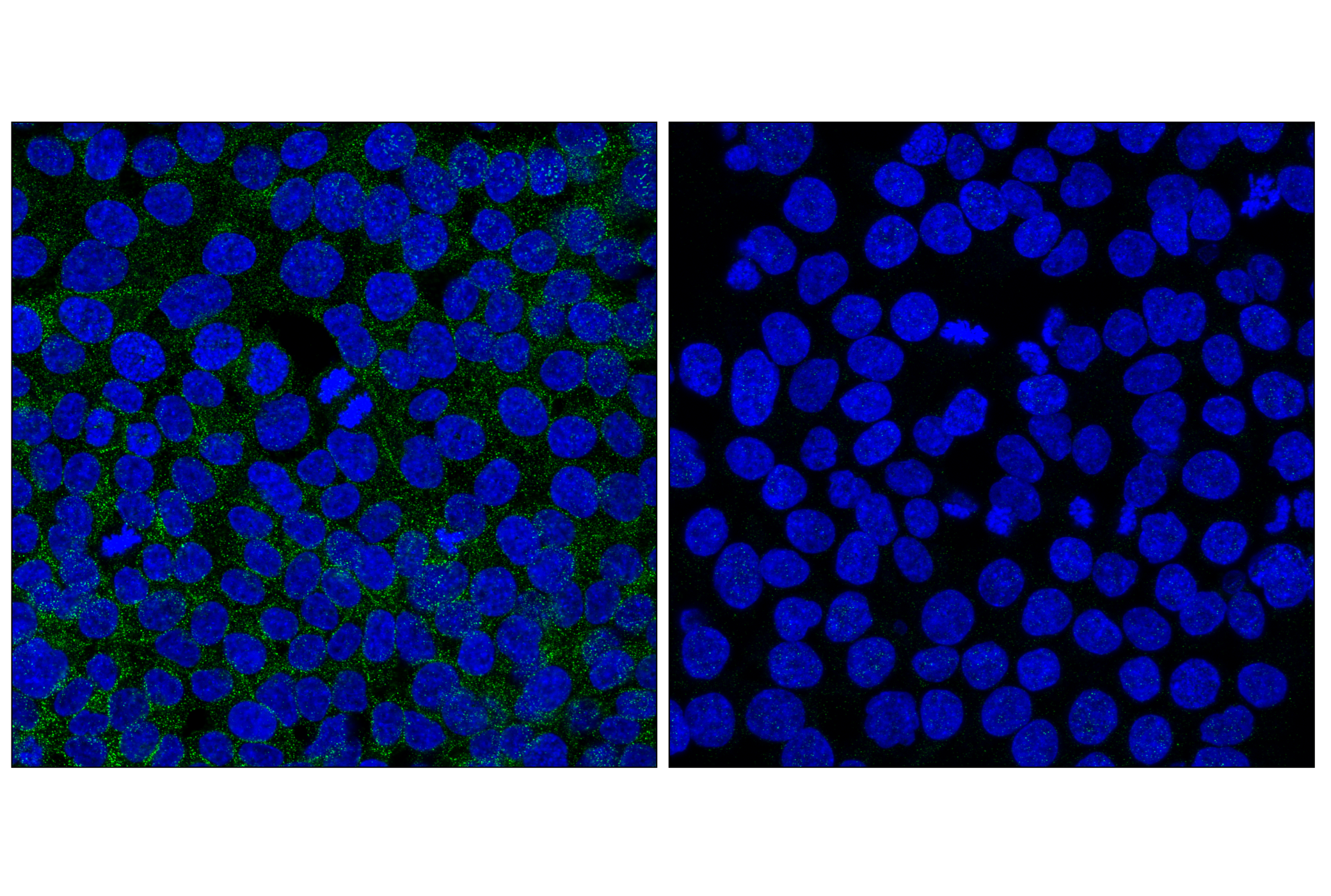 Immunofluorescence Image 5: Numb (C29G11) Rabbit mAb