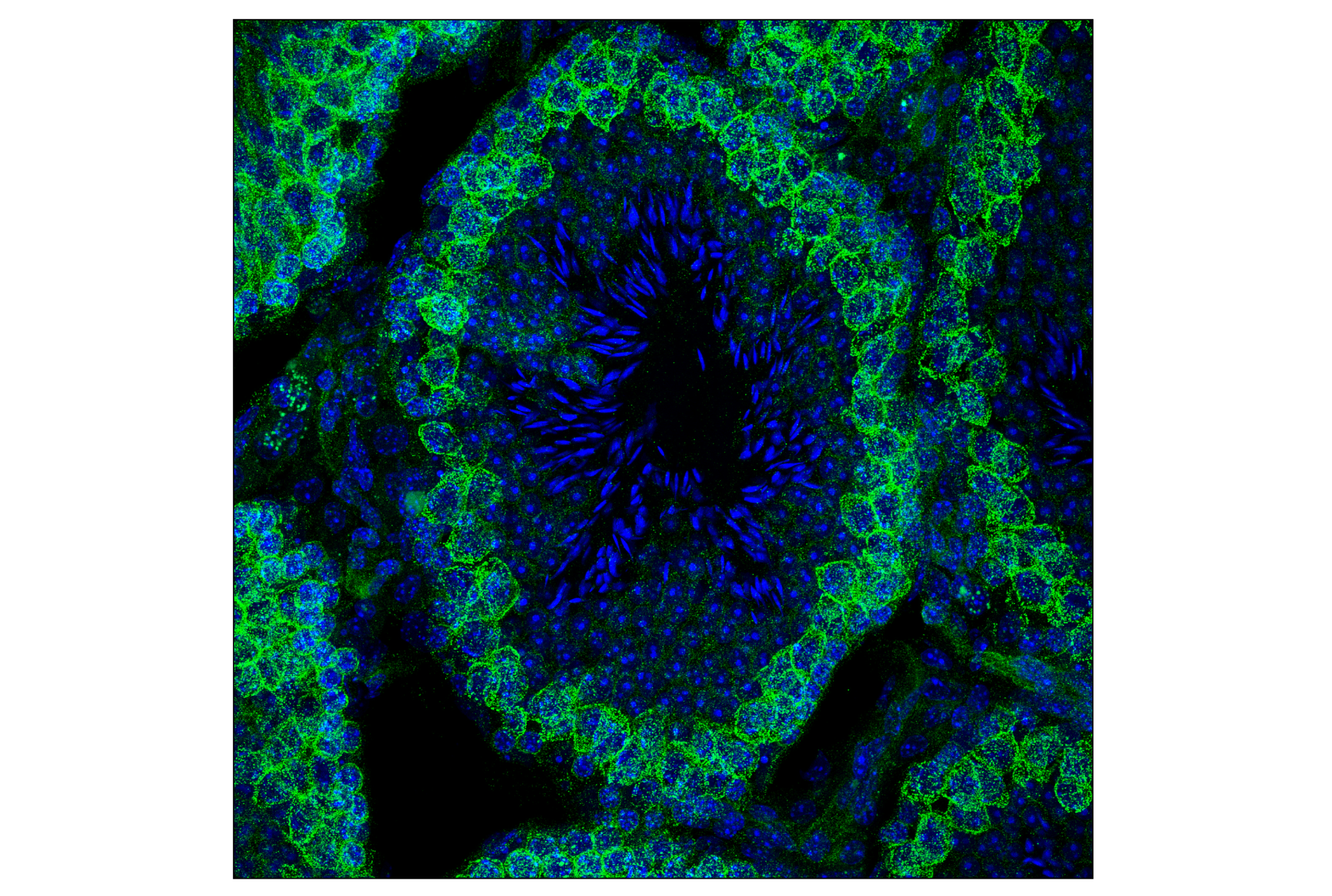Immunofluorescence Image 1: Numb (C29G11) Rabbit mAb