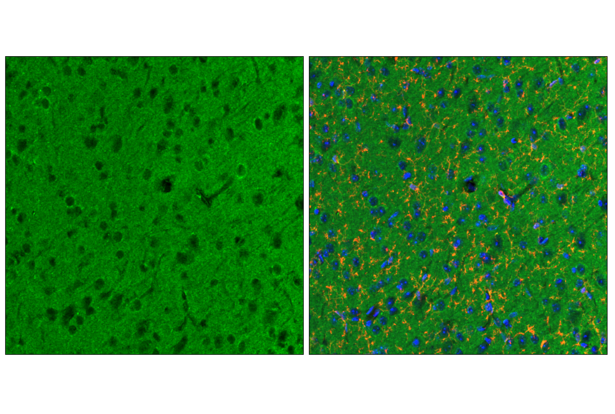 Immunofluorescence Image 2: Numb (C29G11) Rabbit mAb