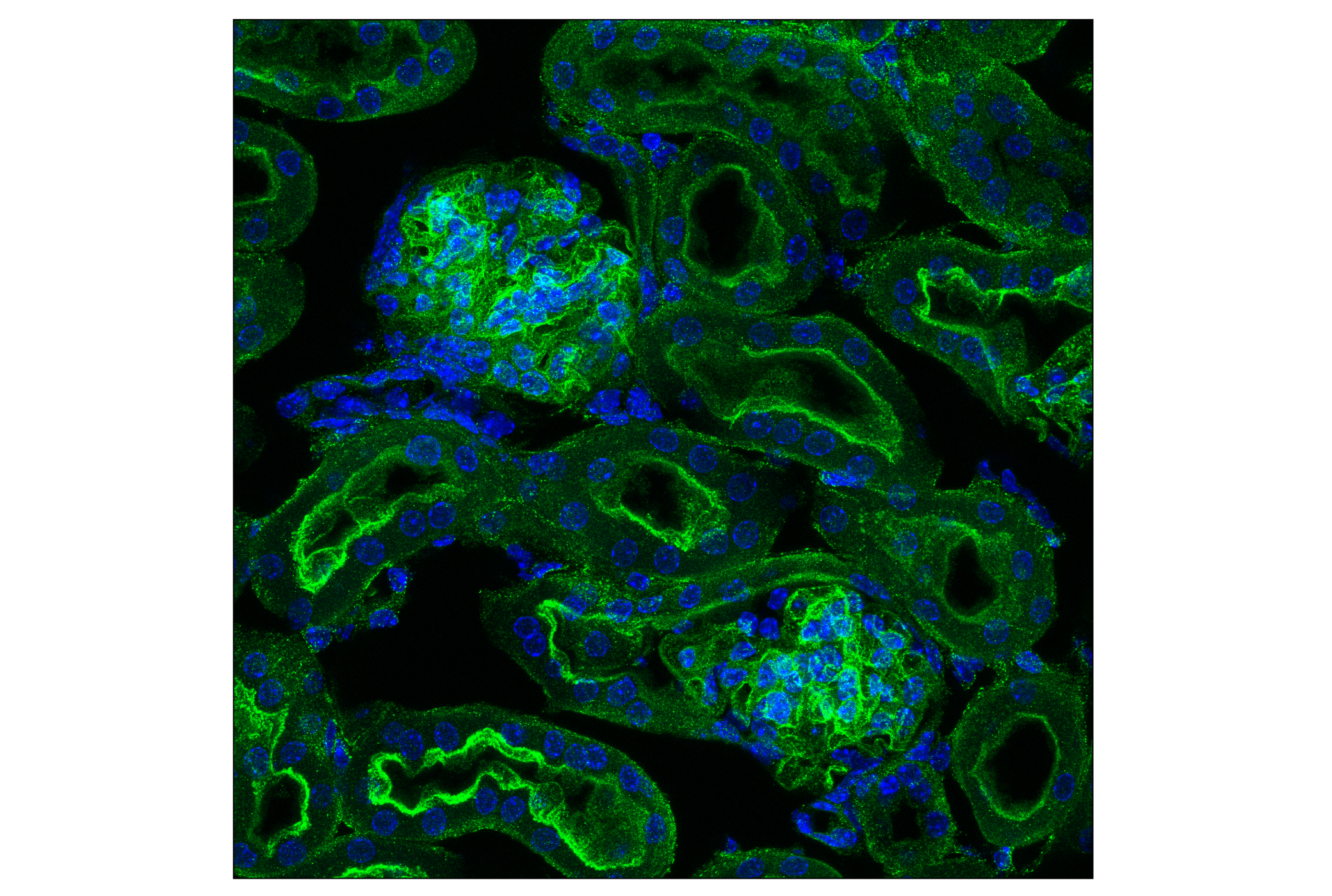 Immunofluorescence Image 4: Numb (C29G11) Rabbit mAb