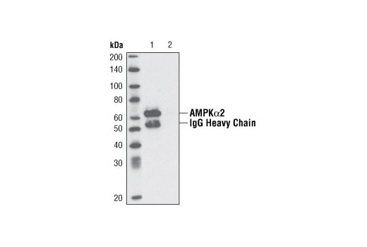  Image 11: AMPK Subunit Antibody Sampler Kit