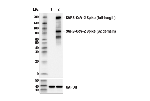 Western Blotting Image 1: SARS-CoV-2 Spike Protein (S2) (E7V3M) Rabbit mAb