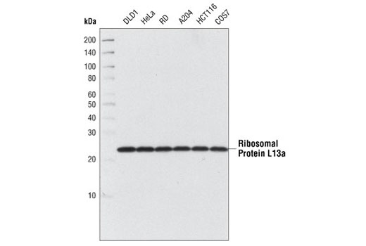Western Blotting Image 1: Ribosomal Protein L13a Antibody