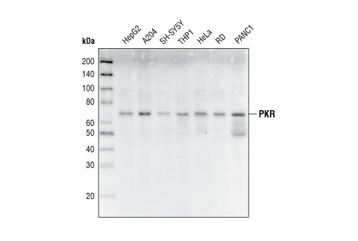 Western Blotting Image 1: PKR (N216) Antibody