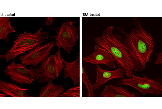 Immunofluorescence Image 1: Acetyl-Histone H3 (Lys36) (D9T5Q) Rabbit mAb