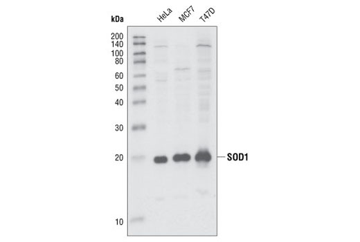 Western Blotting Image 1: SOD1 Antibody