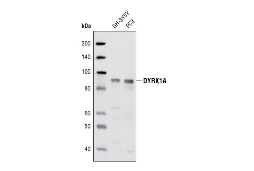 Western Blotting Image 1: DYRK1A Antibody