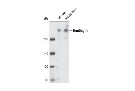 Western Blotting Image 1: Huntingtin Antibody
