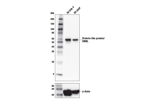 Western Blotting Image 1: Drebrin-like protein/DBNL Antibody