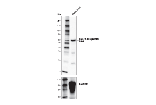 Western Blotting Image 2: Drebrin-like protein/DBNL Antibody