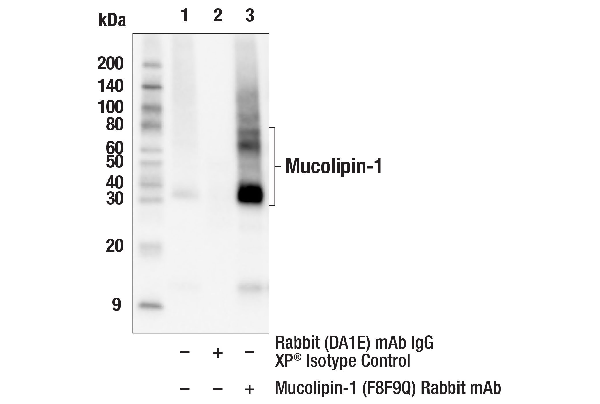 Immunoprecipitation Image 1: Mucolipin-1 (F8F9Q) Rabbit mAb