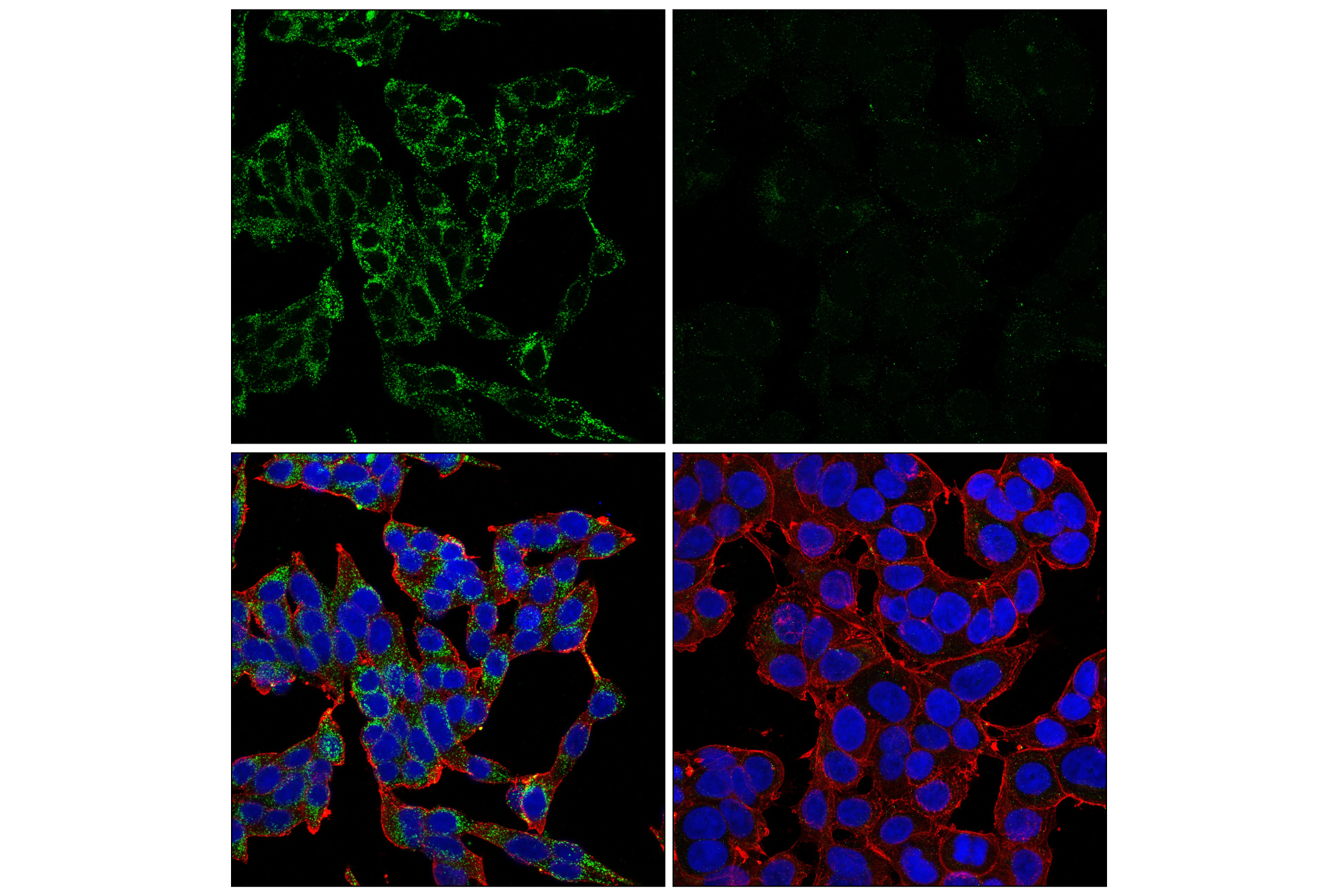 Immunofluorescence Image 1: Mucolipin-1 (F8F9Q) Rabbit mAb