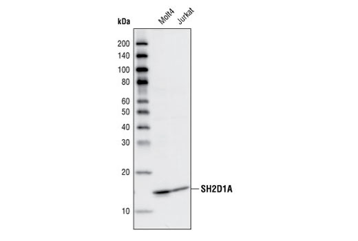 Western Blotting Image 1: SH2D1A Antibody