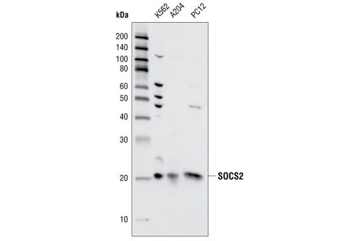  Image 1: Jak/Stat Pathway Inhibitors Antibody Sampler Kit