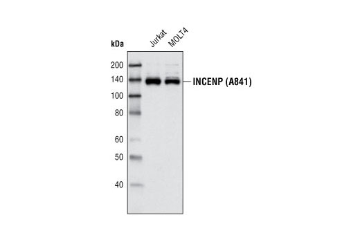Western Blotting Image 1: INCENP (A841) Antibody