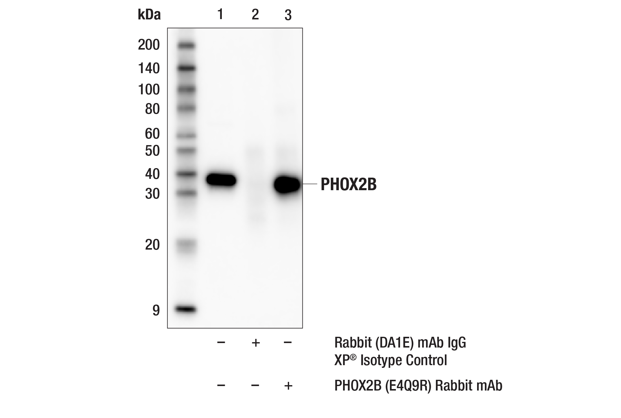 Immunoprecipitation Image 1: PHOX2B (E4Q9R) Rabbit mAb