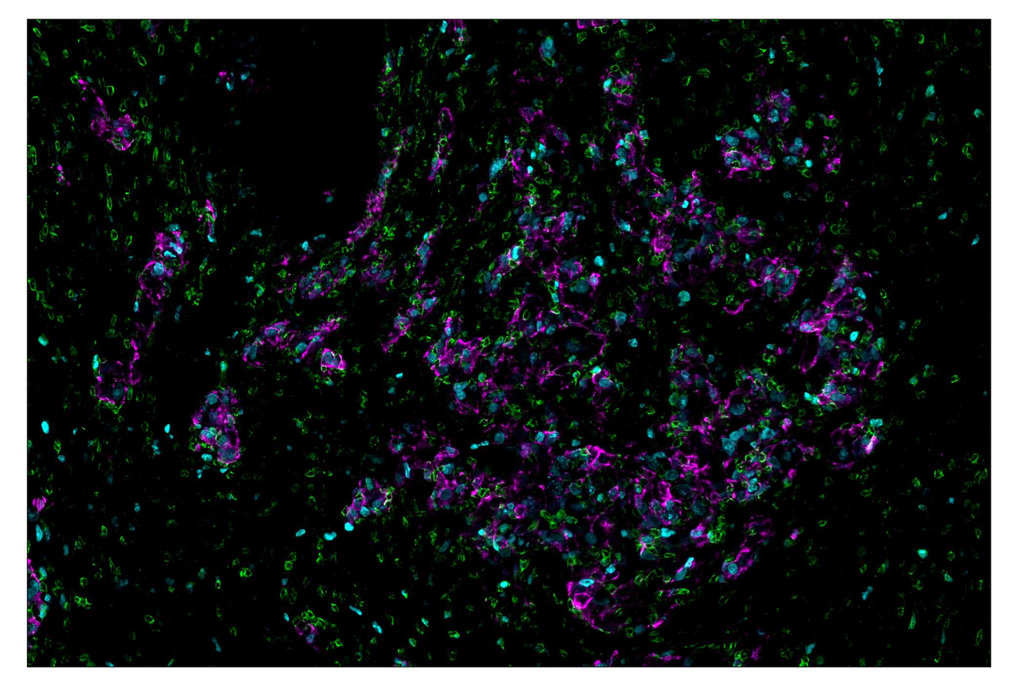 undefined Image 4: Cleaved Caspase-3 (Asp175) (D3E9) & CO-0118-594 SignalStar<sup>™</sup> Oligo-Antibody Pair