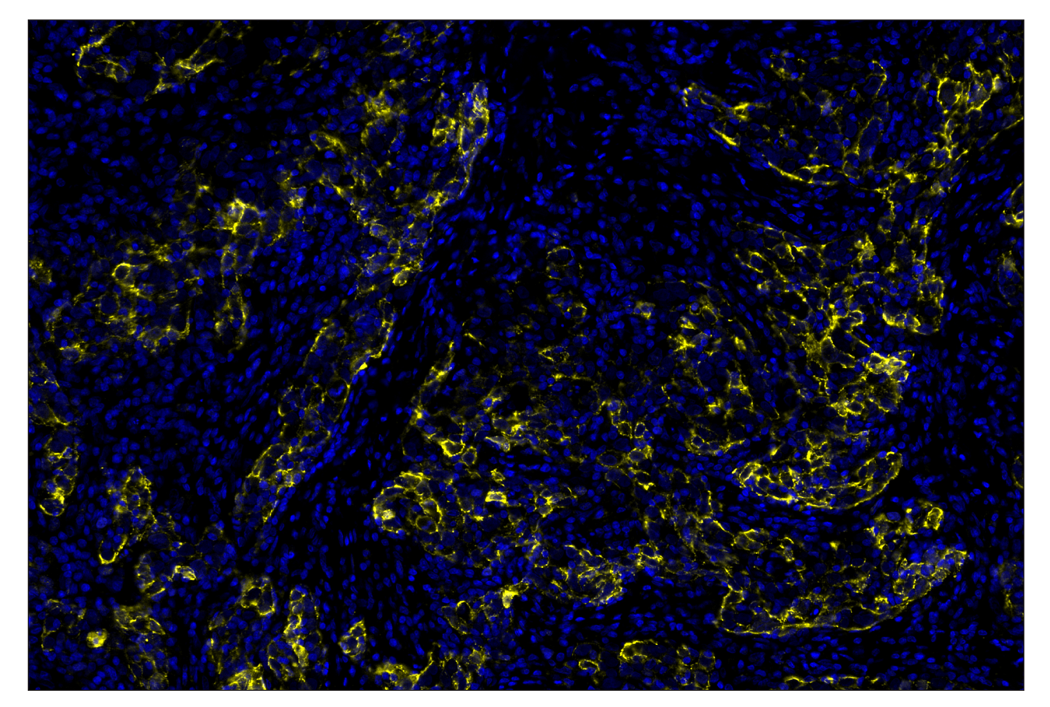 undefined Image 2: Cleaved Caspase-3 (Asp175) (D3E9) & CO-0118-594 SignalStar<sup>™</sup> Oligo-Antibody Pair