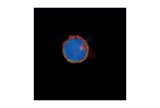 Immunofluorescence Image 1: Lck (73A5) Rabbit mAb