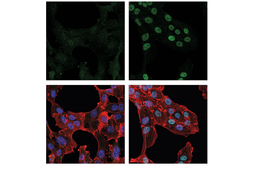 Immunofluorescence Image 1: XBP-1s (E8C2Z) Mouse mAb