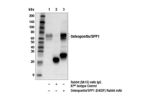 Immunoprecipitation Image 1: Osteopontin/SPP1 (E4O2F) Rabbit mAb