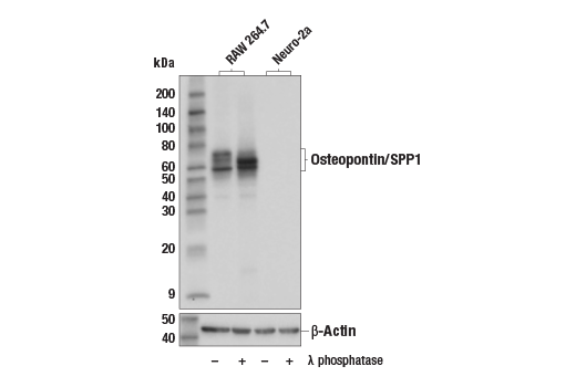 Western Blotting Image 1: Osteopontin/SPP1 (E4O2F) Rabbit mAb