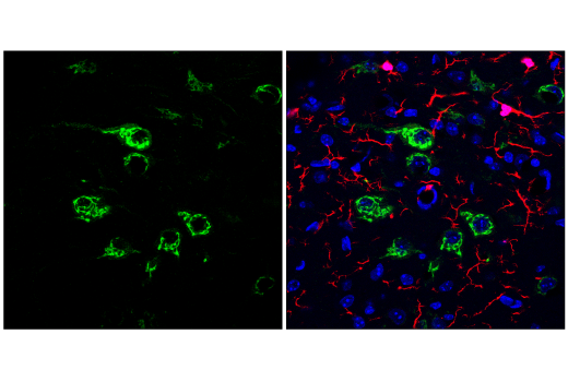 Immunofluorescence Image 1: Osteopontin/SPP1 (E4O2F) Rabbit mAb
