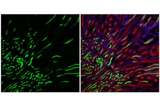 Immunofluorescence Image 2: Osteopontin/SPP1 (E4O2F) Rabbit mAb
