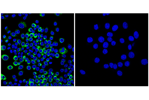 Immunofluorescence Image 3: Osteopontin/SPP1 (E4O2F) Rabbit mAb