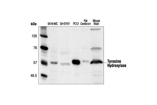 Western Blotting Image 1: Tyrosine Hydroxylase Antibody