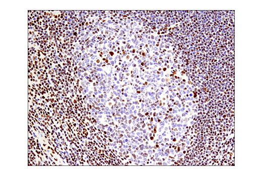Immunohistochemistry Image 10: Phospho-ATF-2 (Thr71)/ATF-7 (Thr53) (E4A5G) XP® Rabbit mAb