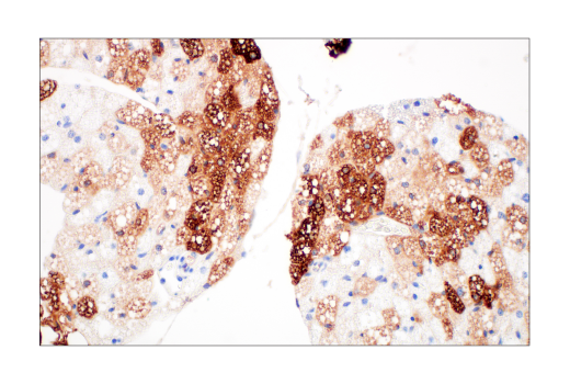 Immunohistochemistry Image 5: SCD1 (C12H5) Rabbit mAb