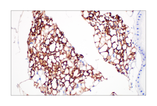Immunohistochemistry Image 6: SCD1 (C12H5) Rabbit mAb