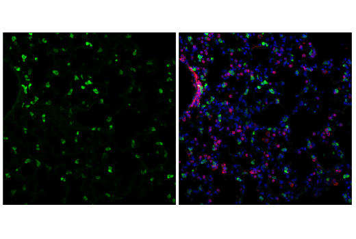 Immunofluorescence Image 1: SCD1 (C12H5) Rabbit mAb