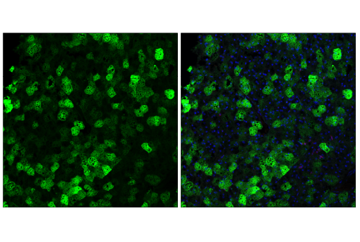 Immunofluorescence Image 3: SCD1 (C12H5) Rabbit mAb