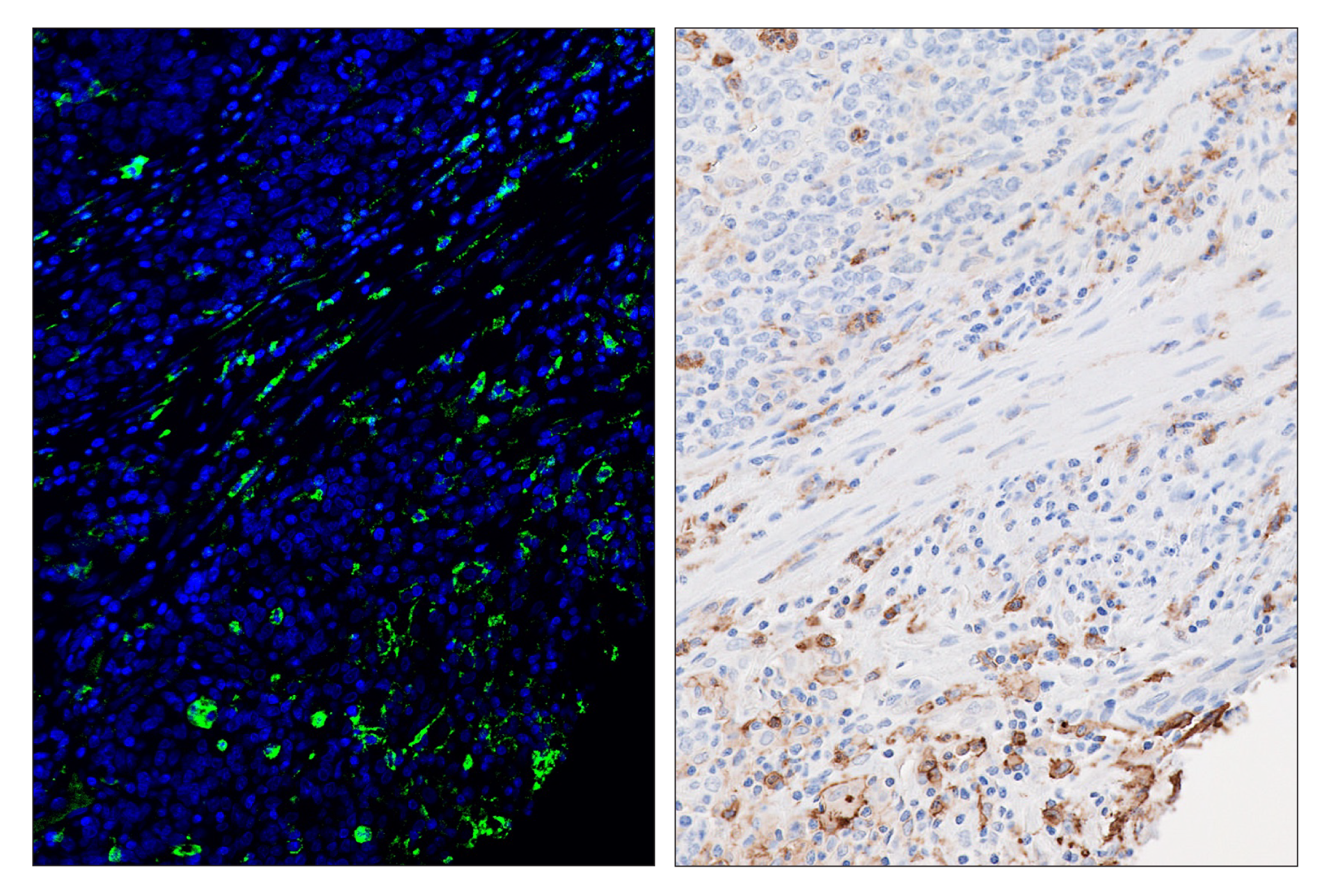 Immunohistochemistry Image 6: CD16 (D1N9L) & CO-0031-488 SignalStar™ Oligo-Antibody Pair