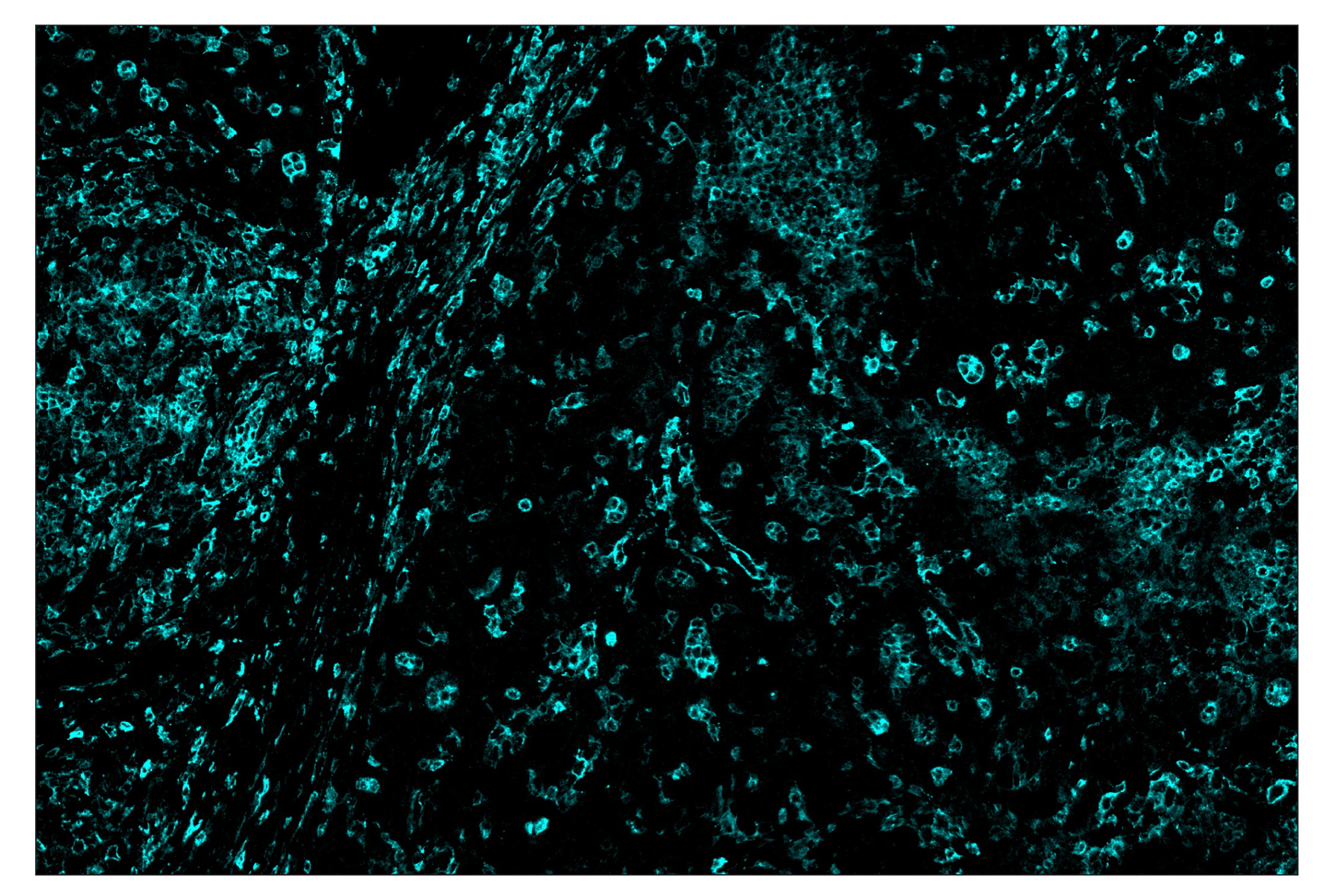 Immunohistochemistry Image 5: CD16 (D1N9L) & CO-0031-750 SignalStar™ Oligo-Antibody Pair