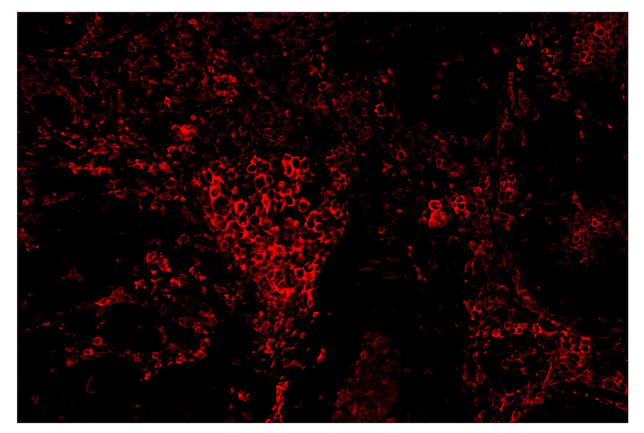 Immunohistochemistry Image 4: CD16 (D1N9L) & CO-0031-750 SignalStar™ Oligo-Antibody Pair
