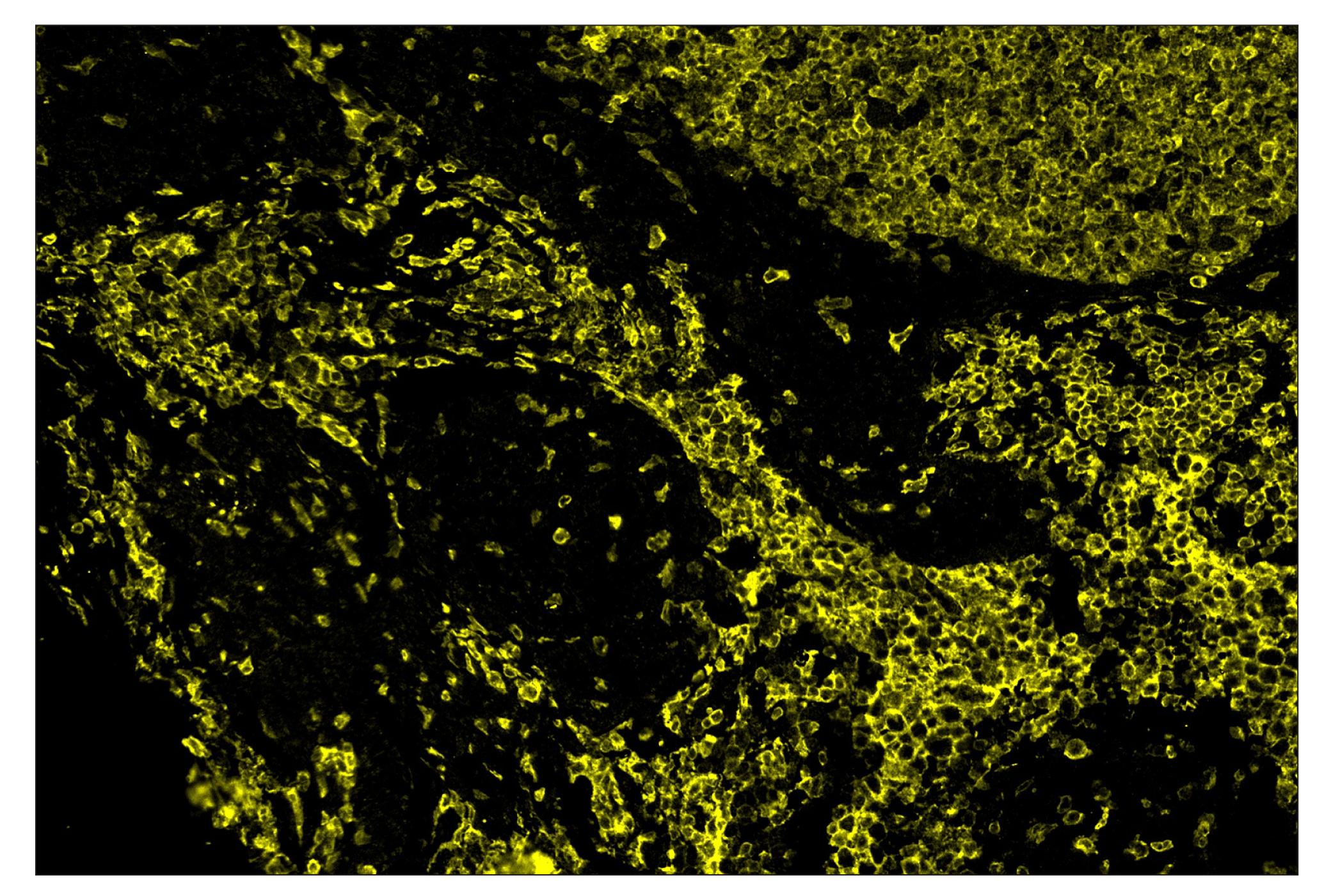 Immunohistochemistry Image 3: CD16 (D1N9L) & CO-0031-594 SignalStar™ Oligo-Antibody Pair