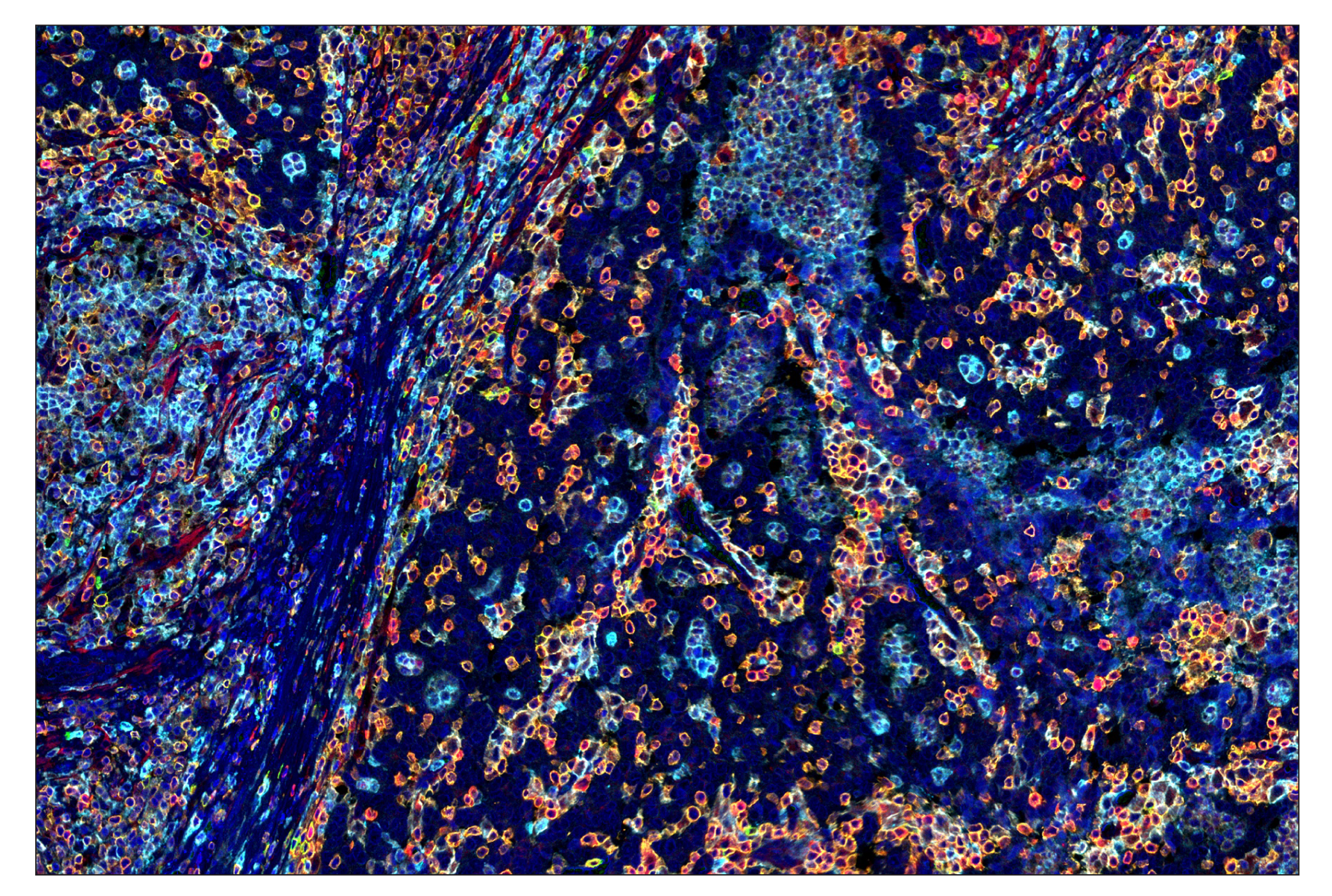 Immunohistochemistry Image 7: CD16 (D1N9L) & CO-0031-750 SignalStar™ Oligo-Antibody Pair