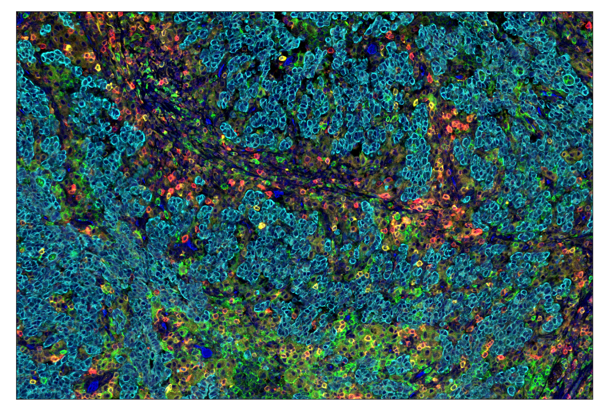 Immunohistochemistry Image 8: CD16 (D1N9L) & CO-0031-488 SignalStar™ Oligo-Antibody Pair
