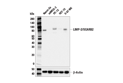  Image 18: Lysosomal Marker Antibody Sampler Kit