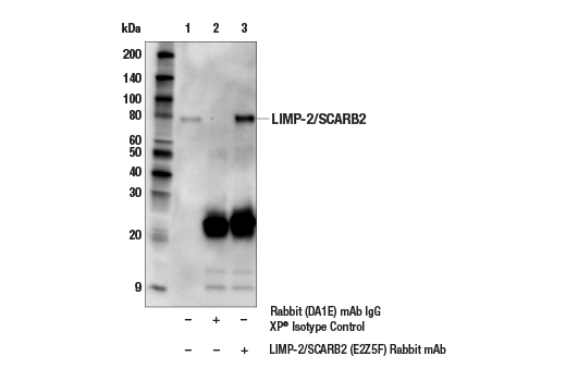 Immunoprecipitation Image 1: LIMP-2/SCARB2 (E2Z5F) Rabbit mAb