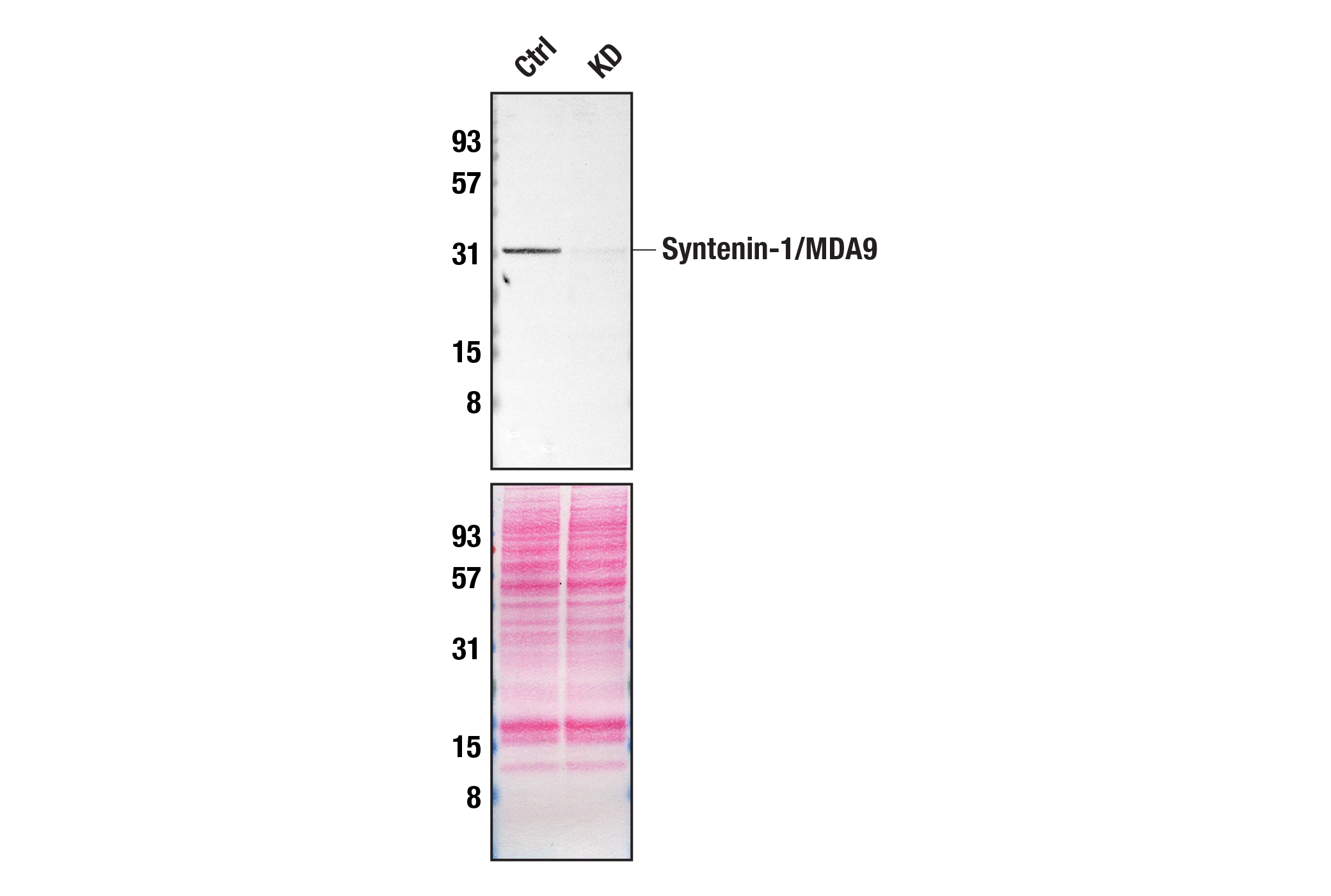 Western Blotting Image 2: Syntenin-1/MDA9 (E2I9L) Rabbit Monoclonal Antibody